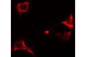 ABIN6274949 staining A549  cells by IF/ICC. (CLIP3 抗体  (Internal Region))