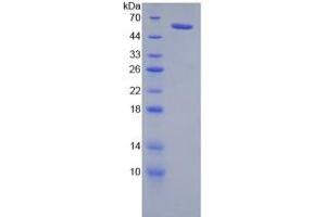 SDS-PAGE analysis of Rat Neuropilin 2 Protein. (NRP2 蛋白)