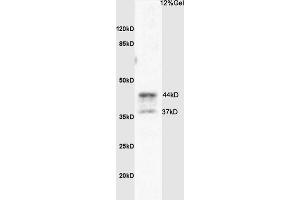 Rat brain lysates probed with Anti PAR4 Polyclonal Antibody, Unconjugated (ABIN673224) at 1:200 overnight at 4 °C.