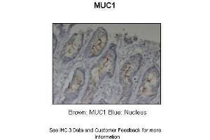 Sample Type :  Pig stomach  Primary Antibody Dilution :  1:5000 + 1:2000  Secondary Antibody :  Anti-rabbit-HRP  Secondary Antibody Dilution :  1:1000  Color/Signal Descriptions :  Brown: MUC1 Blue: Nucleus  Gene Name :  MUC1  Submitted by :  Dr. (MUC1 抗体  (C-Term))