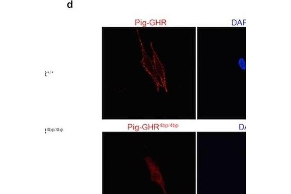 Growth Hormone Receptor 抗体  (AA 101-200)