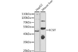Western blot analysis of extracts of various cell lines, using ECSIT antibody (ABIN6130352, ABIN6139923, ABIN6139924 and ABIN6223767) at 1:1000 dilution. (ECSIT 抗体  (AA 50-296))