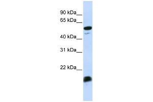 WB Suggested Anti-C4BPA Antibody Titration:  0. (C4BPA 抗体  (Middle Region))
