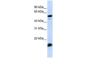 WB Suggested Anti-C4BPA Antibody Titration:  0.
