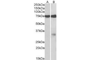 ABIN571279 (2µg/ml) staining of fetal Mouse (A) and Rat (B) Brain lysates (35µg protein in RIPA buffer). (GPM6A 抗体  (Internal Region))
