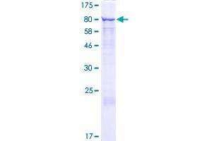 GRHL2 Protein (AA 1-625) (GST tag)