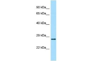 Host: Rabbit Target Name: ABHD14A Sample Type: Fetal Kidney lysates Antibody Dilution: 1. (ABHD14A 抗体  (Middle Region))
