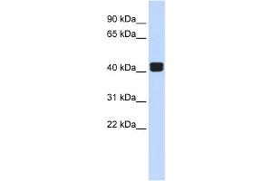 WB Suggested Anti-TRIOBP Antibody Titration:  0. (TRIOBP 抗体  (Middle Region))