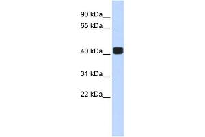 WB Suggested Anti-TRIOBP Antibody Titration:  0.