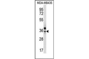Western blot analysis of OR51Q1 Antibody (N-term) in MDA-MB435 cell line lysates (35ug/lane). (OR51Q1 抗体  (N-Term))