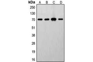 Western blot analysis of S6K1 expression in MCF7 (A), HeLa (B), MDCK (C), mouse brain (D) whole cell lysates. (RPS6KB1 抗体  (C-Term))