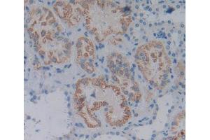 Used in DAB staining on fromalin fixed paraffin- embedded Kidney tissue (IFNE 抗体  (AA 30-208))