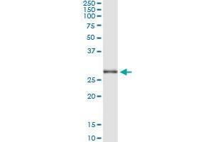 Immunoprecipitation of TRIM72 transfected lysate using anti-TRIM72 monoclonal antibody and Protein A Magnetic Bead , and immunoblotted with TRIM72 MaxPab rabbit polyclonal antibody. (TRIM72 抗体  (AA 378-477))