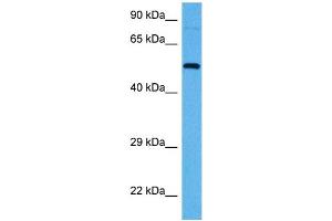 Western Blotting (WB) image for anti-SRY (Sex Determining Region Y)-Box 9 (SOX9) (C-Term) antibody (ABIN2780338)