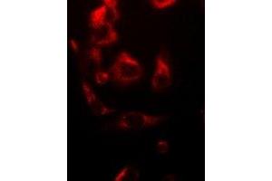 Immunofluorescent analysis of NDUFV1 staining in A549 cells. (NDUFV1 抗体)