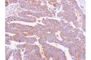 Immunohistochemistry (IHC) image for anti-Dystroglycan 1 (DAG1) antibody (ABIN2856020)