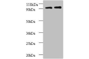 Western blot All lanes: RPS12 antibody at 2 μg/mL Lane 1: EC109 whole cell lysate Lane 2: 293T whole cell lysate Secondary Goat polyclonal to rabbit IgG at 1/15000 dilution Predicted band size: 15 kDa Observed band size: 90 kDa (RPS12 抗体  (AA 1-132))