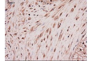 Immunohistochemical staining of paraffin-embedded colon using anti-NTF4 (ABIN2452547) mouse monoclonal antibody. (Neurotrophin 4 抗体  (AA 81-210))