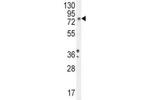 DBH antibody western blot analysis in A2058 lysate