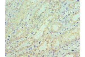 Immunohistochemistry of paraffin-embedded human kidney tissue using ABIN7169843 at dilution of 1:100 (SGTA 抗体  (AA 1-120))