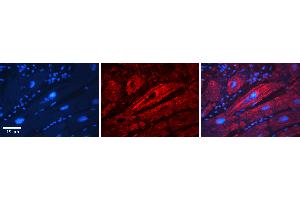 Rabbit Anti-SLC26A3 Antibody  Catalog Number: ARP31608_P050 Formalin Fixed Paraffin Embedded Tissue: Human Adult heart  Observed Staining: Membrane Primary Antibody Concentration: 1:100 Secondary Antibody: Donkey anti-Rabbit-Cy2/3 Secondary Antibody Concentration: 1:200 Magnification: 20X Exposure Time: 0. (SLC26A3 抗体  (Middle Region))