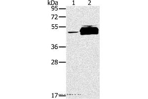 Western blot analysis of K562 cell and human testis tissue, using PTPN20B Polyclonal Antibody at dilution of 1:200 (PTPN20 抗体)