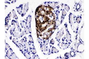 IHC analysis of ATP citrate lyase using anti- ATP citrate lyase antibody . (ACLY 抗体  (AA 1-180))