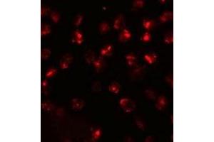 Immunofluorescencent staining of 3T3 cells with ATP2C2 polyclonal antibody  at 20 ug/mL. (ATP2C2 抗体  (N-Term))