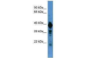 Western Blotting (WB) image for anti-Solute Carrier Family 18 (Vesicular Monoamine Transporter), Member 1 (SLC18A1) (N-Term) antibody (ABIN2505523) (SLC18A1 抗体  (N-Term))