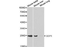Western blot analysis of extracts of various cell lines, using UCP3 antibody. (UCP3 抗体  (AA 1-110))