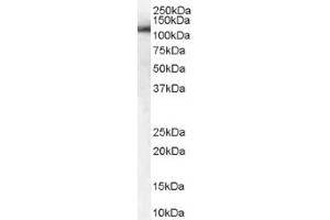 Image no. 1 for anti-USO1 Homolog, Vesicle Docking Protein (USO1) (C-Term) antibody (ABIN374624) (USO1 抗体  (C-Term))