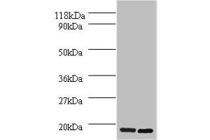 Western blot All lanes: H2AFJ antibody at 2 μg/mL Lane 1: Mouse brain tissue Lane 2: MCF-7 whole cell lysate Secondary Goat polyclonal to rabbit IgG at 1/10000 dilution Predicted band size: 15, 17 kDa Observed band size: 15 kDa (H2AFJ 抗体  (AA 2-129))