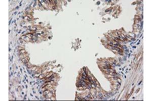 Immunohistochemical staining of paraffin-embedded Human prostate tissue using anti-CDCP1 mouse monoclonal antibody. (CDCP1 抗体)