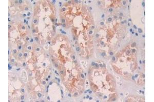 Immunohistochemistry (IHC) image for anti-Telomeric Repeat Binding Factor (NIMA-Interacting) 1 (TERF1) (AA 148-428) antibody (ABIN7438715)