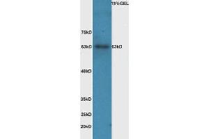 Lane 1: mouse intestinal lysate probed with Rabbit Anti-IL-1R1(Tyr496) Polyclonal Antibody, Unconjugated  at 1:5000 for 90 min at 37˚C. (IL1R1 抗体  (pTyr496))