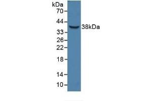 Detection of Recombinant HPR, Human using Polyclonal Antibody to Haptoglobin Related Protein (HPR) (HPR 抗体  (AA 70-332))