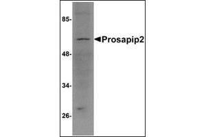 Western blot analysis of Prosapip2 in rat liver tissue lysate with this product at 1 μg/ml. (TBKBP1 抗体  (C-Term))
