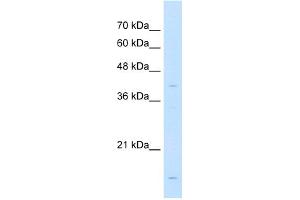 WB Suggested Anti-LMAN2 Antibody Titration:  1 ug/ml  Positive Control:  Jurkat cell lysate (LMAN2 抗体  (N-Term))