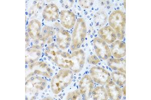 Immunohistochemistry of paraffin-embedded rat kidney using INHBC antibody (ABIN5975306) at dilution of 1/100 (40x lens). (INHBC 抗体)