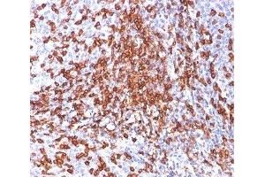 IHC testing of human tonsil stained with HCAM antibody (156-3C11). (CD44 抗体)