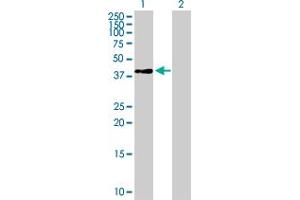 Western Blot analysis of LOC388524 expression in transfected 293T cell line by LOC388524 MaxPab polyclonal antibody. (RPSAP58 抗体  (AA 1-295))