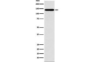 Western blot analysis of Sodium / Hydrogen Exchanger 1 expression in MOLT4 cell lysate.