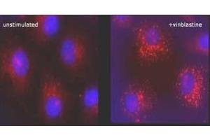 Immunofluorescence (IF) image for anti-Microtubule-Associated Protein 1 Light Chain 3 beta (MAP1LC3B) (N-Term) antibody (ABIN492614) (LC3B 抗体  (N-Term))