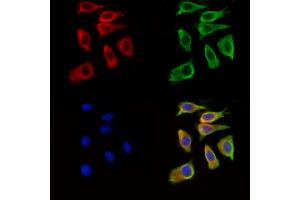 ABIN7094888 and ABIN7098941 staining Hela cells by IF/ICC. (IL21 Receptor 抗体  (Internal Region))