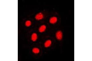 Immunofluorescent analysis of HNF4 alpha (pS313) staining in SW480 cells. (HNF4A 抗体  (pSer313))