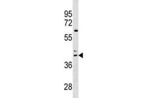 CCR4 antibody western blot analysis in HL-60 lysate (CCR4 抗体  (AA 262-290))
