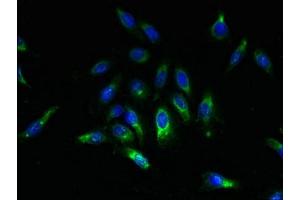 Immunofluorescent analysis of Hela cells using ABIN7169615 at dilution of 1:100 and Alexa Fluor 488-congugated AffiniPure Goat Anti-Rabbit IgG(H+L) (SPCS2 抗体  (AA 7-86))
