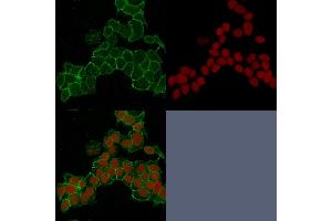 Confocal immunofluorescence image of HeLa cells using Catenin, gamma Mouse Monoclonal Antibody (15F11) Green (CF488) and Reddot is used to label the nuclei Red. (JUP 抗体)