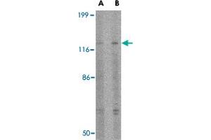 Western blot analysis of SLITRK3 in SK-N-SH cell lysate with SLITRK3 polyclonal antibody  at (A) 0. (SLITRK3 抗体  (C-Term))