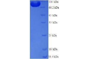 SDS-PAGE (SDS) image for 5-Methyltetrahydrofolate-Homocysteine Methyltransferase Reductase (MTRR) (AA 1-725), (full length) protein (His tag) (ABIN5714506) (MTRR Protein (AA 1-725, full length) (His tag))